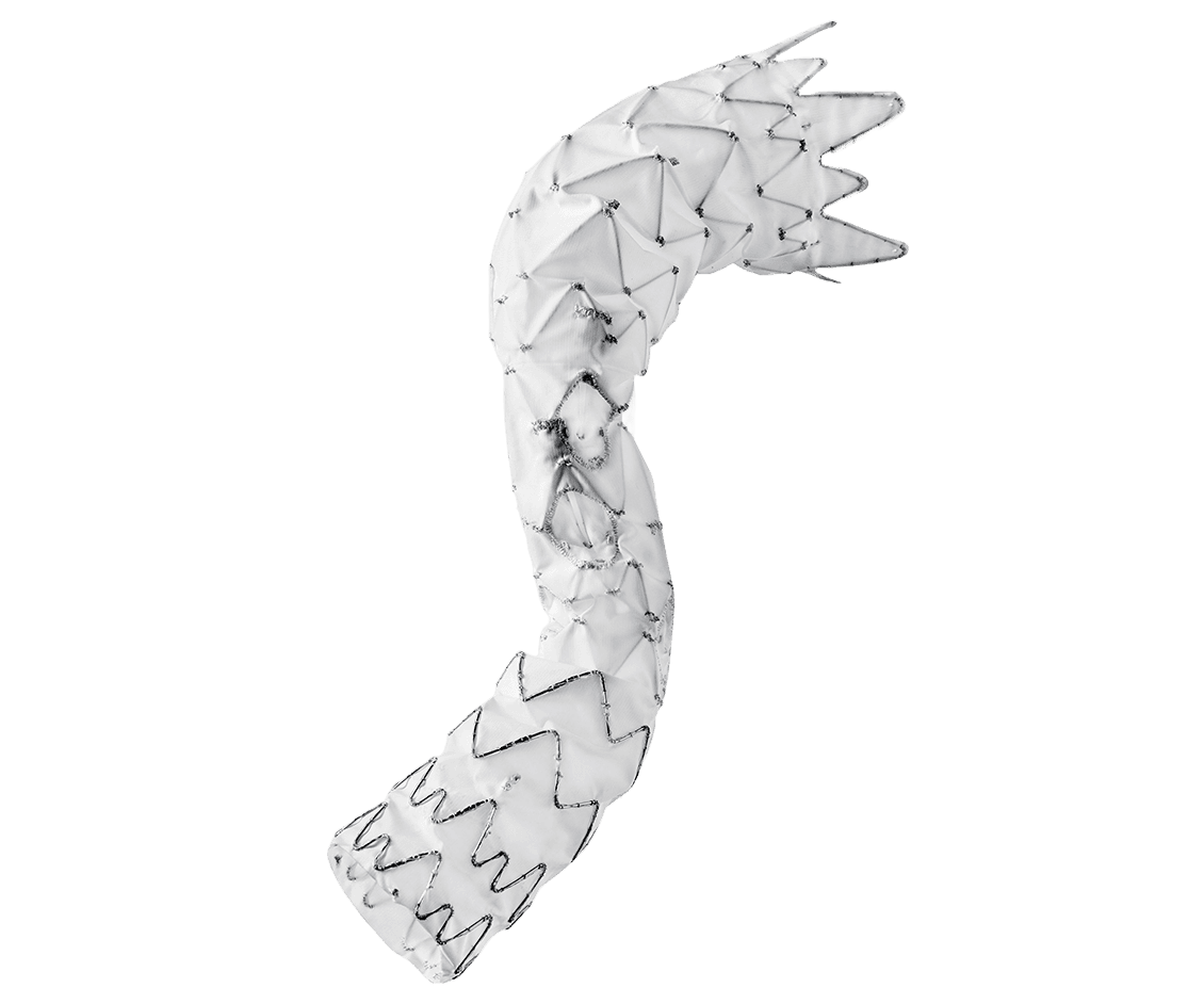 E-nside™ Inner Branch Stent Graft System
