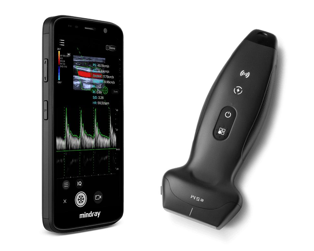 TE Air Wireless Handheld Ultrasound Family